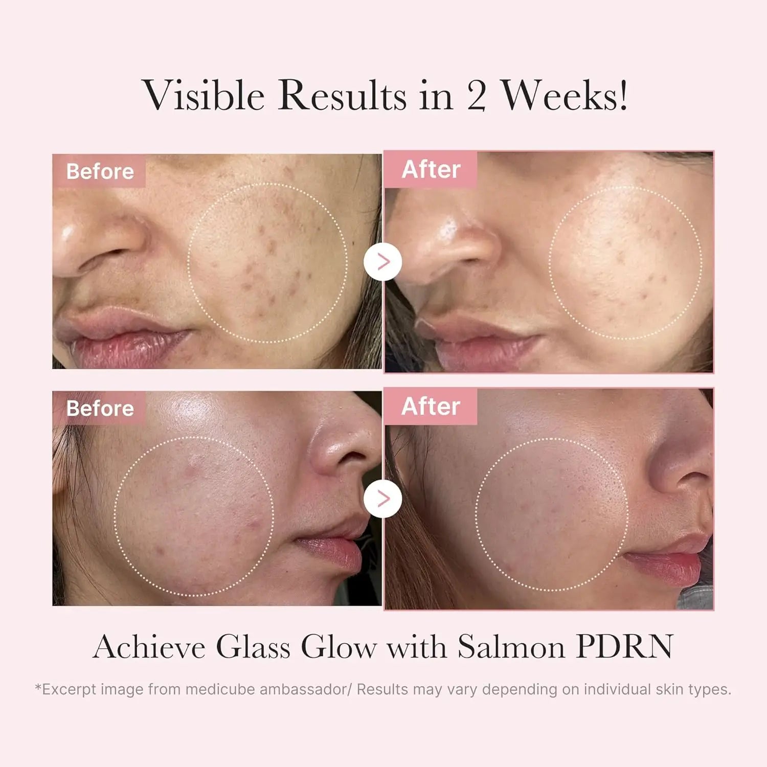 medicube PDRN Trial Kit  Glass Glow Mini Skincare Set with Toner Serum  Sheet Mask for Hydrating Firming Moisturizing